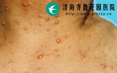 ��ͬ��λ�Ĵ�״������ʲô����֢״