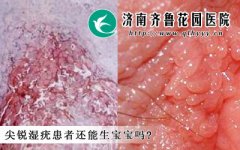 ���м���ʪ��ķ��޻�����������