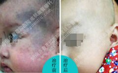 �������ϳ������ɫ��̥�Ǹ���ô��