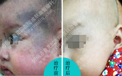 ��ԺƤ���ƽ����һλ���ϳ������ɫ̥�ǵ�С���ߣ������Ϊ̫���룬��ô������̫����ķ���������̫�����ҽԺ�ļҺ��ء�