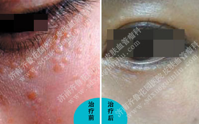 ����Ƥ�ϳ��˺�������ȥ����Ŀǰ��Ժ����������Ʒ����кܶ࣬ר��ָ�����ڻ����ڼ��м����ּ�ѹ���������̻�������ô�������������Ʒ�����ʲô��