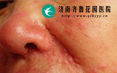 �����ǻ����ճ�������Ҫ�������õ���ʳϰ�߱�����Ƥ����