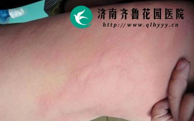 ����ݡ������һ�ֹ����Ե�Ƥ������