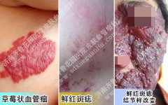 ��ݮ״Ѫ�������ʺ�������������Щ