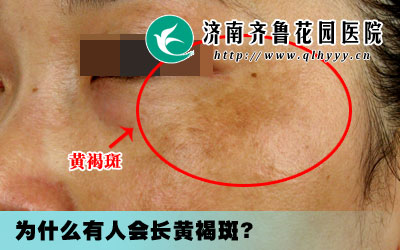 ������ϳ��ƺְ߸���ô���أ�ÿ��������ϴ���ɾ�һ�����Ƿǳ����˿��յ�һ�����飬��ô��ȥ���ƺְߵ���ѷ�����ʲô���������ƻƺְ�Ч����Ρ�