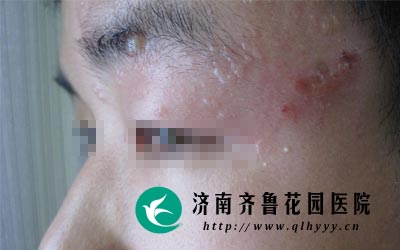 �沿�������в�����Ⱦ������һ���Ĵ�Ⱦ�ԡ�