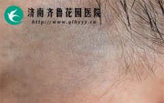 ̫������ʲôΣ����