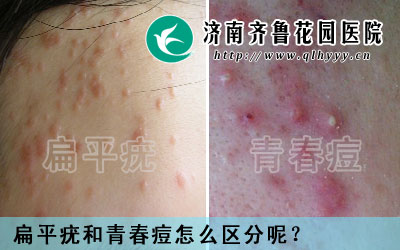 ��������׶��ഺ�����Ǻܳ����ģ��������ϳ�����Ҳ����һ�����ഺ����Ҳ�п����Ǳ�ƽ�࣬��ô����ƽ����ഺ����ô�����ء�