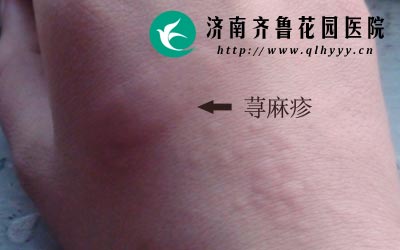 �и�����ݡ�����Ҫץ�ӻ�����Ҫ�ҷ����κ�ҩ�