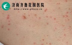 ������ë�������ë������