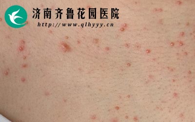 ������ë��ᵼ��Ƥ�����ֺ��׻���ŧ���Ӷ�����ë���ס�