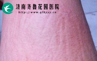 ����ݡ���Ҫ�Ժ��ʲ�Ʒ�Լ��׵���Ƥ��������ʳ�