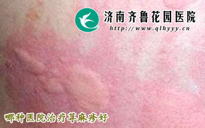 ݡ�����ڼ��Է�����ȫ������������У�ͬʱ������д�С��״��һ�ķ��ų��֣���ô������ҽԺ����ݡ����ã�ݡ������ε����ء�