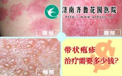 ���ƴ�״������Ҫ����Ǯ