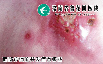 �沿��Ӹ����ʱ�׵��¸�Ⱦ��ɢ���粻��ʱ�������ƣ�����Σ�����ǵ����彡������ô���沿��Ӹ�Ĳ���֢����Щ�ء�