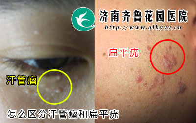 ��ô���ֺ������ͱ�ƽ�࣬������������������������Χ����ƽ��÷�����λ�������Ͷ�ͷ����ô������ֻ����������