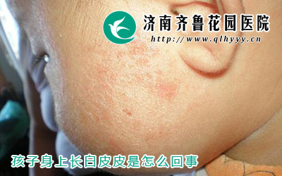 �������ϳ���ƤƤӦ�û�����ʪ���һ�ֱ��֣���ô��ʲô�Ǹ���ʪ����Ԥ������ʪ���ء�