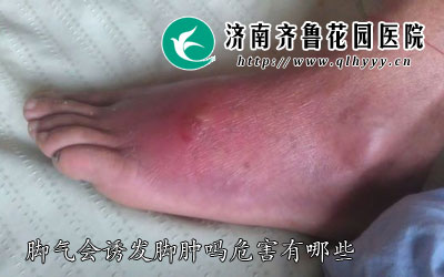 ����Ҳ����Ѣ����Ҫ���ܵ������Ⱦ��������һ�ּ�����Ҳ������Ѣ��һ�֣���ô��������Σ������Щ�أ������ᵼ�½�����