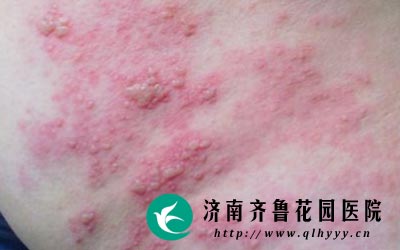 �������ۻ��ߵֿ����½�ʱ�ͻ�������״���