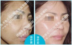 ���ϵ�ȸ����ô����Ч���ȽϺ�