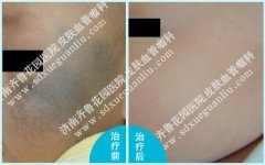 ��������κ�Ӥ�����ϵ�̫������