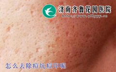 ��������µĶ��Ӷ�ӡ��ȥ����