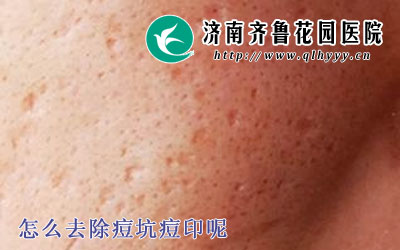 ��ôȥ�����Ӷ�ӡ