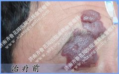 50�����������Ƥ�����ʺ������ô��