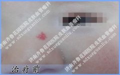 �ճ�����Ӥ���������к�̥����ô��