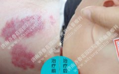 �������ϳ�������Ʋ����׻���