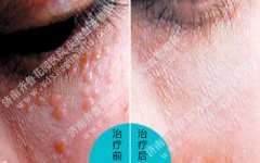 �۲���������ʲôҩ����������