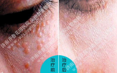 �������ƺ�����