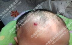 ����ͷ�ϳ����������Щ����������