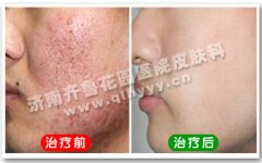 ���ϵĶ�ӡ��ʲô�ð취����ȥ����