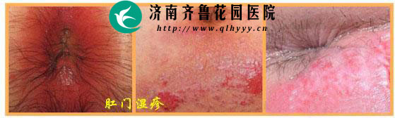 ��������������� ����ж��ǲ��Ǹ���ʪ�� ��������Щ��������ж�