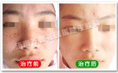 ���ϵ�ȸ�������Ӧ����ô����