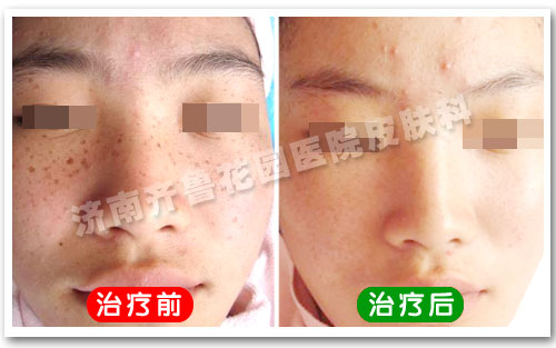 ��Ժ����ȸ�߿�������