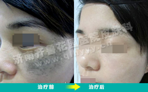 �������ϵ�̫���뾭��Ժ����ǰ��ĶԱ���Ƭ