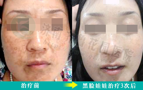 �ƺְ߻�������Ժ����ǰ�����ƺ�ĶԱ���Ƭ