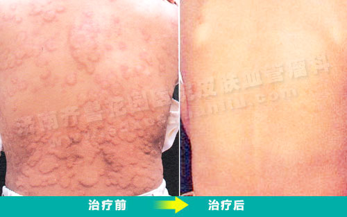 ��ݡ��������ǰ�����ƺ�ĶԱ���Ƭ