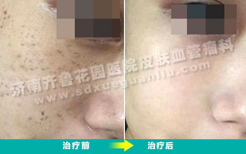 ������³��԰ҽԺƤ����ȸ�߻������ƿ�������