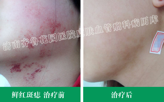 �ʺ���뻼�߾����������Ʒ�����ǰ��Ա���Ƭ