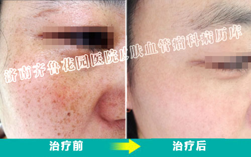 ��Q��������������ҩ���������ȸ�ߵ���÷���