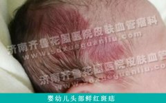 ����һ����ʱ�ʹ�ƬͷƤ��������ô����