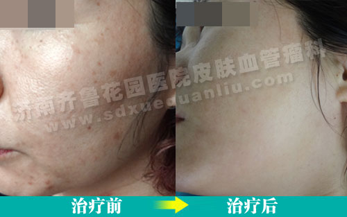 ȸ�߻����ڼ�����³��԰ҽԺƤ���ƾ����������Ʒ�����ǰ��