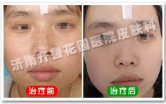 ���ϵ�ȸ��Խ��Խ����ôԤ����������