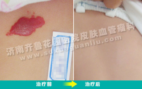 ��Ѫ�������������������Ʒ�����ǰ��Ա���Ƭ