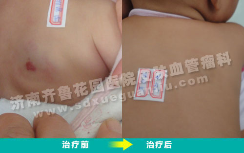 ��Ѫ�������������������Ʒ�����ǰ��Ա���Ƭ