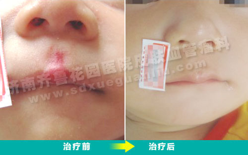 �����ڴ����ĺ��Ƭ�����������Ʒ�����ǰ��Ա���Ƭ