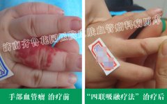 �����ļ�ҽԺ���κñ�����ָ�ϵĺ��Ƭ